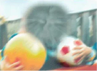 degeneracion-macular_opt