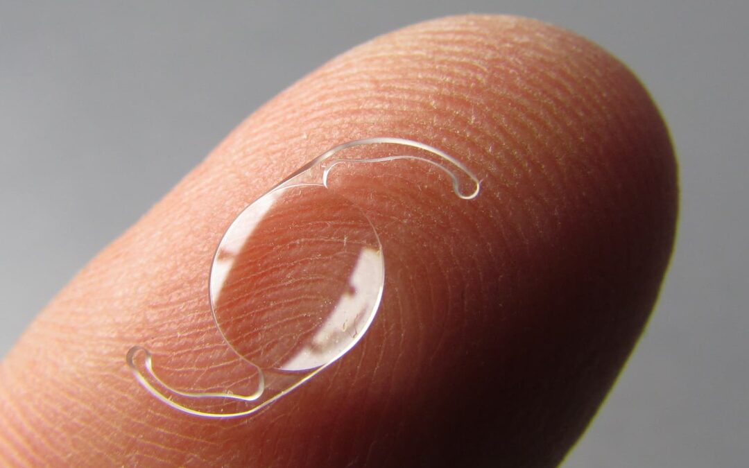 Lentes intraoculares tóricas: una solución para astigmatismo y cataratas