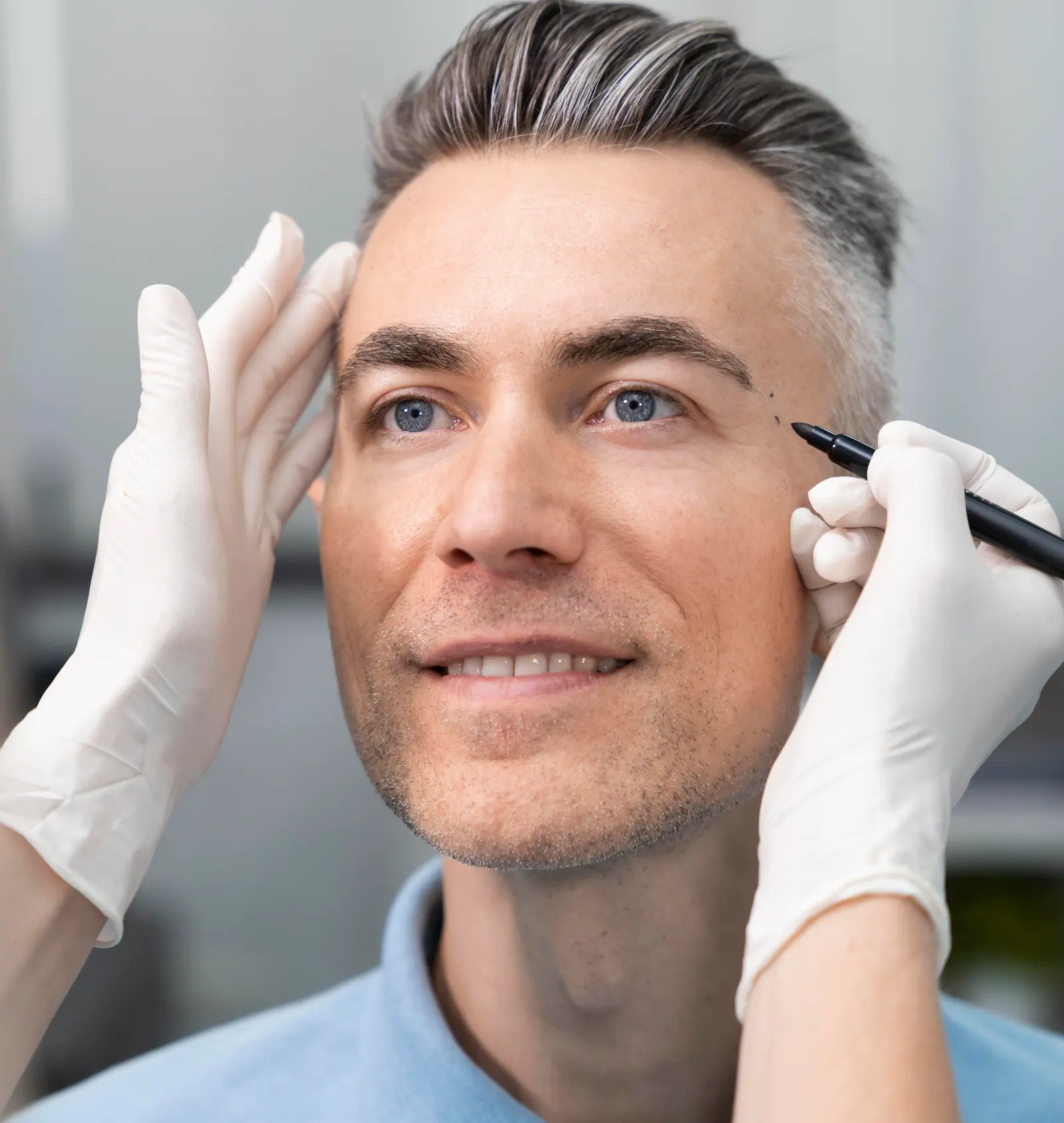 blefaroplastia blefaroplastia en málaga