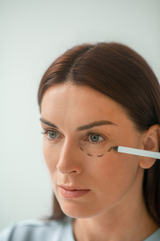 blefaroplastia